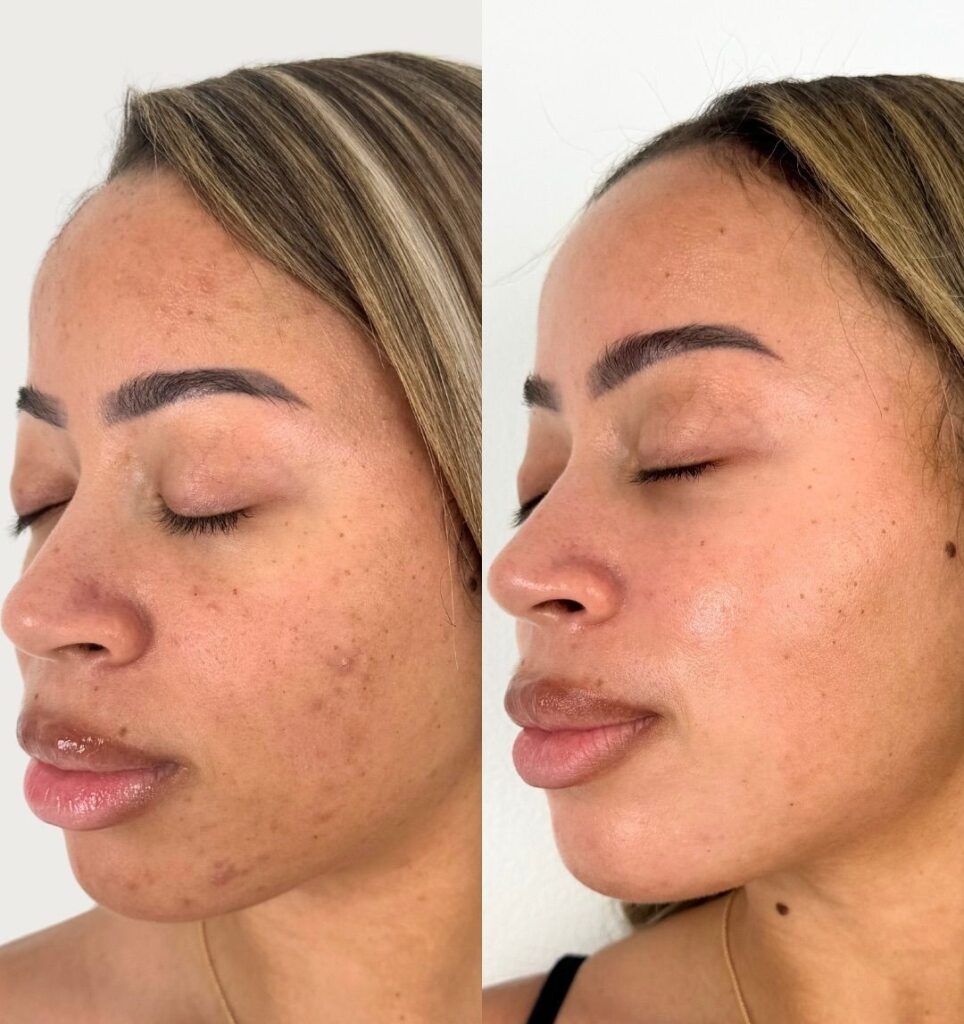 Biocos customer review